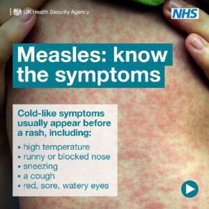 Ukhsa Measles Communications Toolkit 6